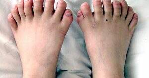 toes.jpg